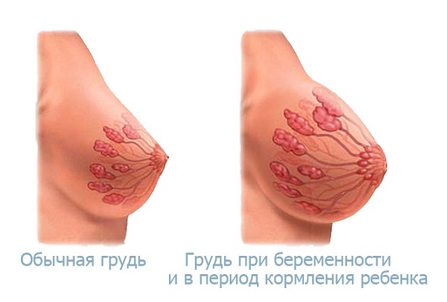 Как увеличbть грудь с помощью nsp