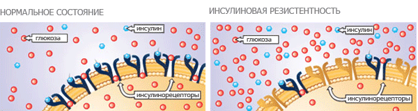 Инсулинорезистентное состояние