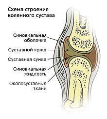 NSP для суставов Молдова