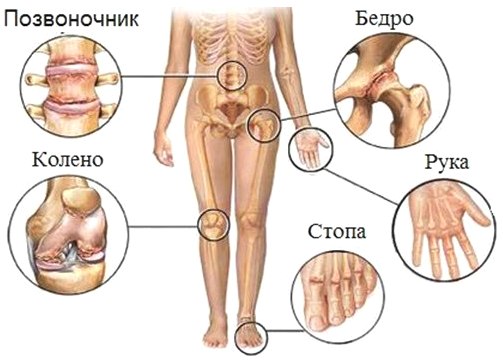 Сера глюкозамин и хондроитин Молдова NSP